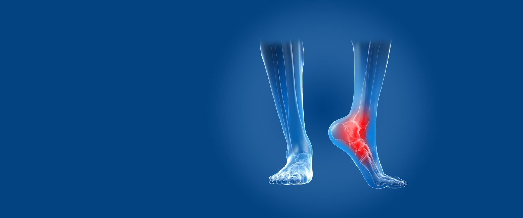 3D rendering of a person's lower leg and feed bones with the heel bones highlighted